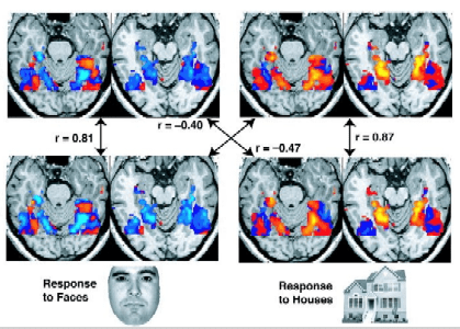 brain images